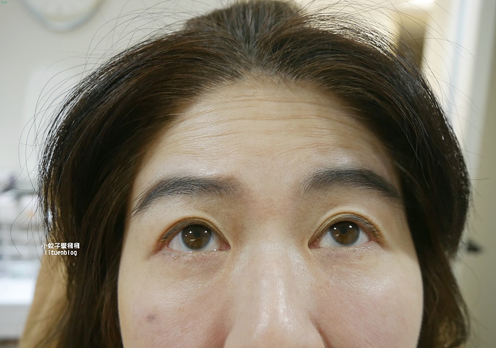 「粹究美學診所」皇家肉毒揮別紋路更持久自然 「粹究美學診所」皇家肉毒揮別紋路更持久自然