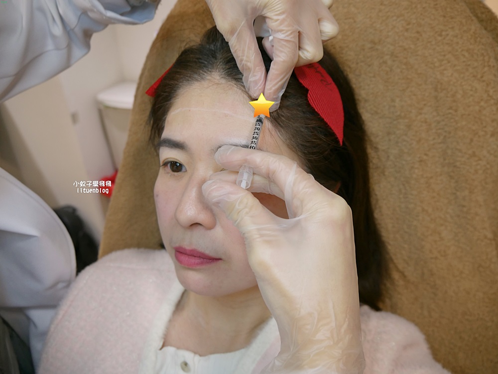 「粹究美學診所」皇家肉毒揮別紋路更持久自然 「粹究美學診所」皇家肉毒揮別紋路更持久自然