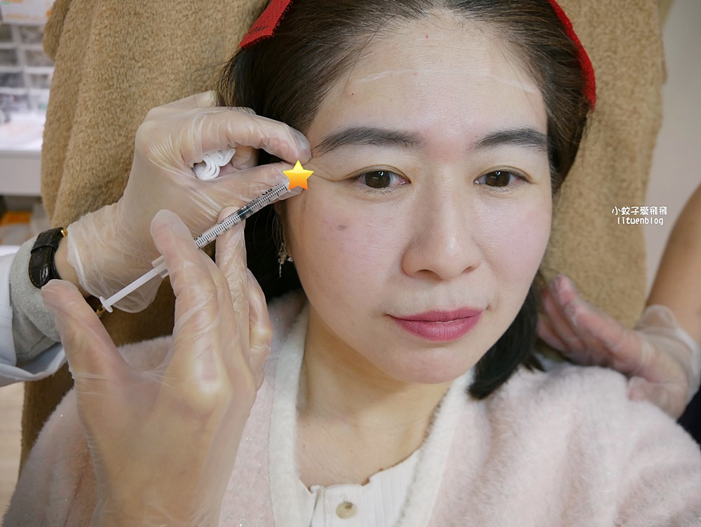 「粹究美學診所」皇家肉毒揮別紋路更持久自然 「粹究美學診所」皇家肉毒揮別紋路更持久自然