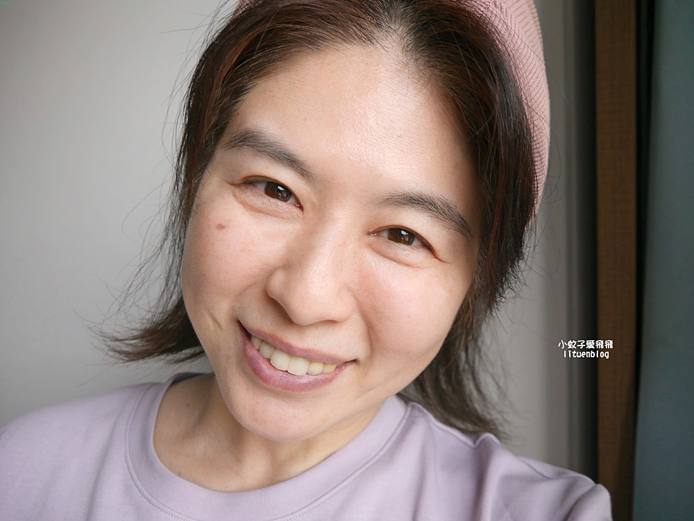 「粹究美學診所」皇家肉毒揮別紋路更持久自然 「粹究美學診所」皇家肉毒揮別紋路更持久自然