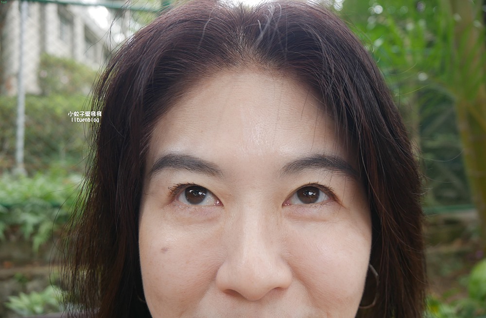 「粹究美學診所」皇家肉毒揮別紋路更持久自然