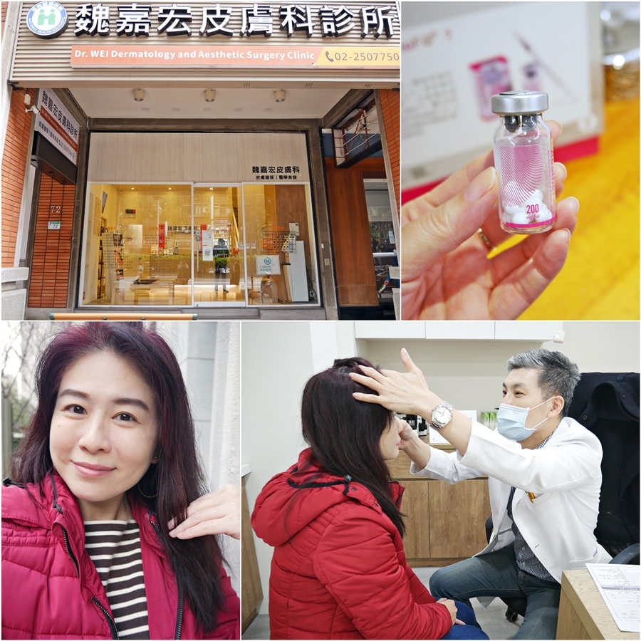 中山國中站「魏嘉宏皮膚科醫美中心」Aesthefill艾麗斯精靈針，澎潤飽滿擁有福氣貴婦容顏 @小蚊子愛飛飛 litwenblog